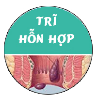 Lòi dom là bệnh gì?