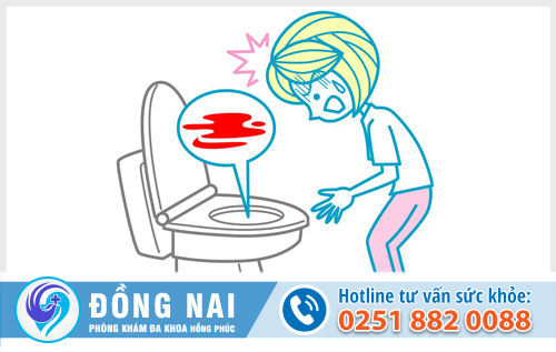 Bệnh trĩ là gì và những tác hại cần biết
