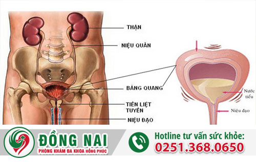 Bí tiểu là bệnh gì