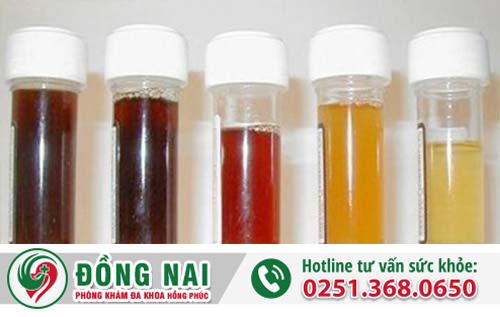 Đái buốt ra máu