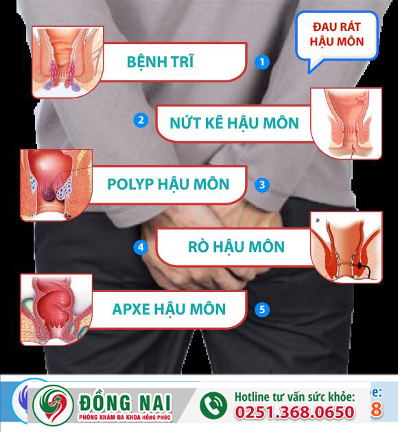 Đau rát hậu môn là dấu hiệu cảnh báo bệnh gì