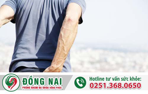 Điều trị nứt kẽ hậu môn như thế nào?