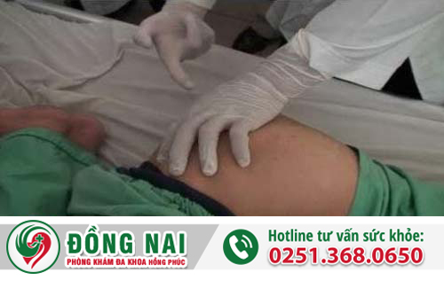 Hậu môn chảy mủ là bị bệnh gì?