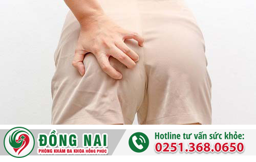 Ngứa hậu môn – Nguyên nhân và cách điều trị hiệu quả