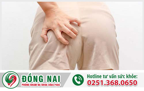Ngứa hậu môn là bị bệnh gì?