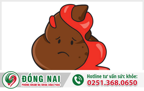 Hiện tượng ỉa ra máu - nguyên nhân chính do đâu?