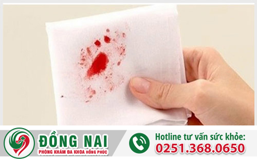 Triệu chứng bệnh ỉa ra máu